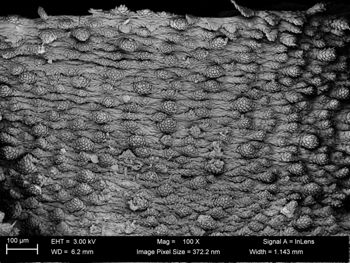 Media type: image;   Invertebrate Zoology 32029 Description: SEM image of specimen.;  Aspect: dorsal